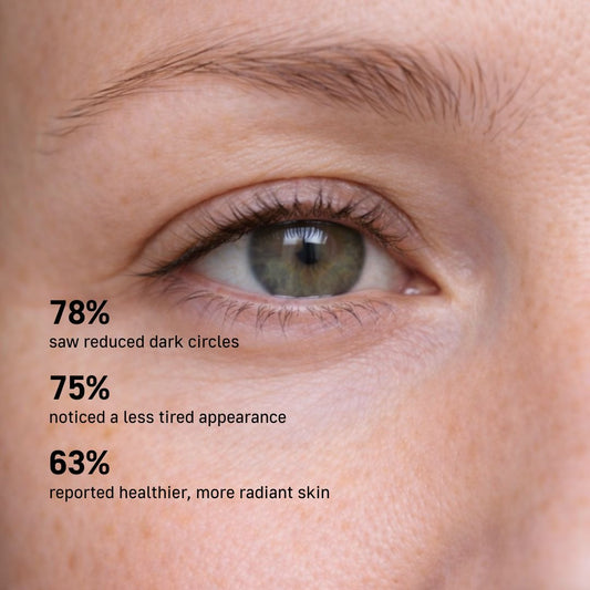 Vermindering van donkere kringen onder de ogen nr. 118