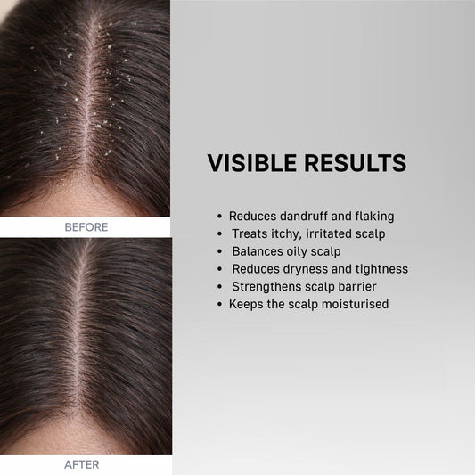 Anti-roos reductie nr. 190